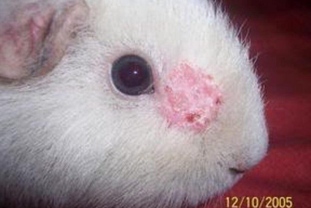 Infecciones en la piel